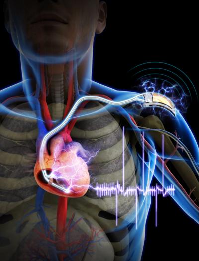 Self-Powered Cardiac Pacemaker