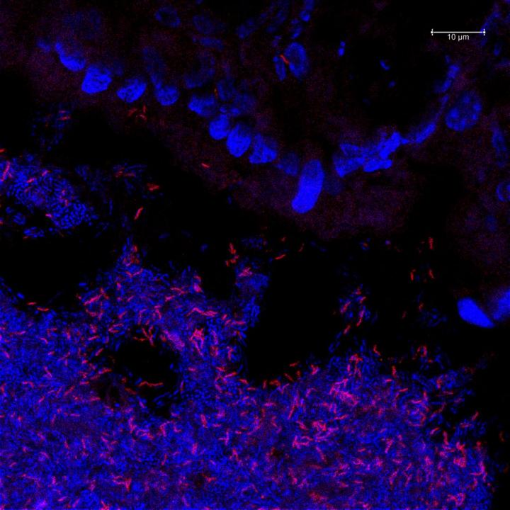 Gut section with fluorescently labelled bacteria / Huimin Ye