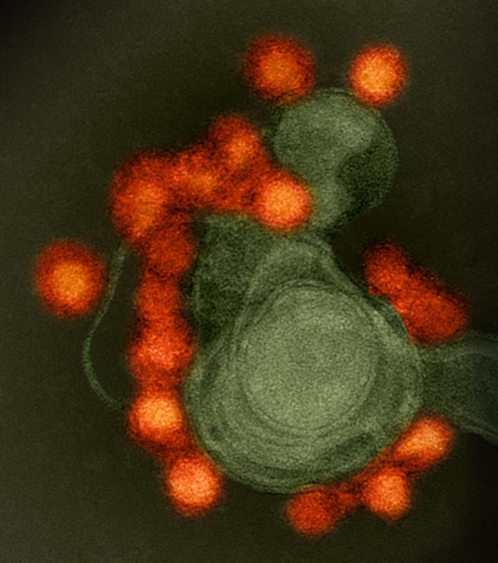 Image of Zika Virus Isolated from a Microcephaly Case in Brazil