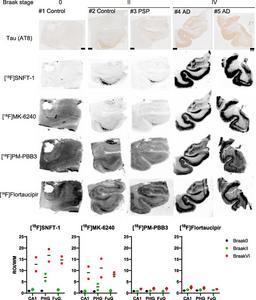 Tau immunohistochemistry and in vitro autoradiograms.