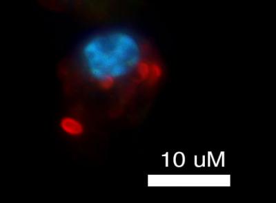 <i>Streptococcus pneumoniae</i>