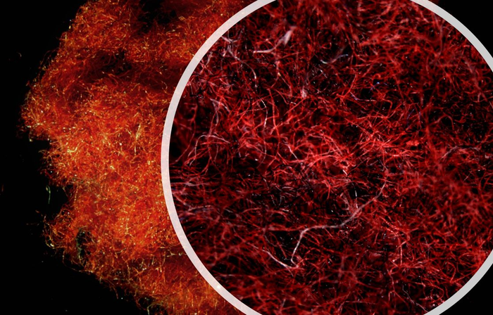 Microscopy of cotton (red) and polyester (black) fibers collected from tumble dryer exhaust.