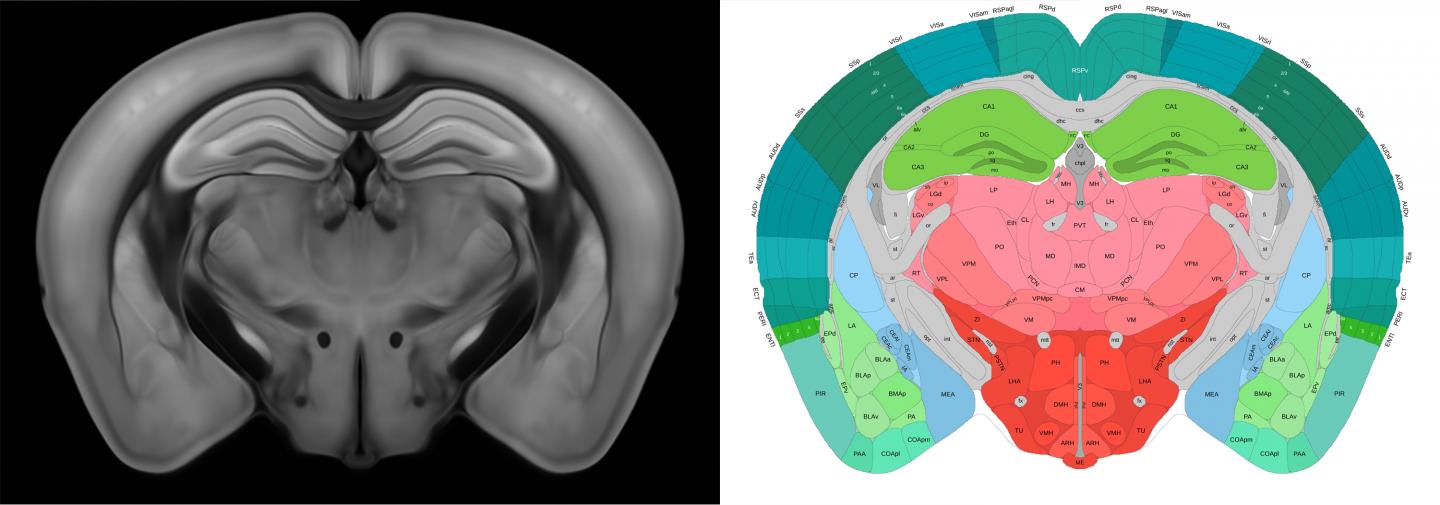 A virtual section of the 3D mouse brain atlas