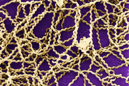 <em>Leptospira</em>