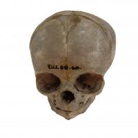 Dissected Fetal Skull (1 of 2)
