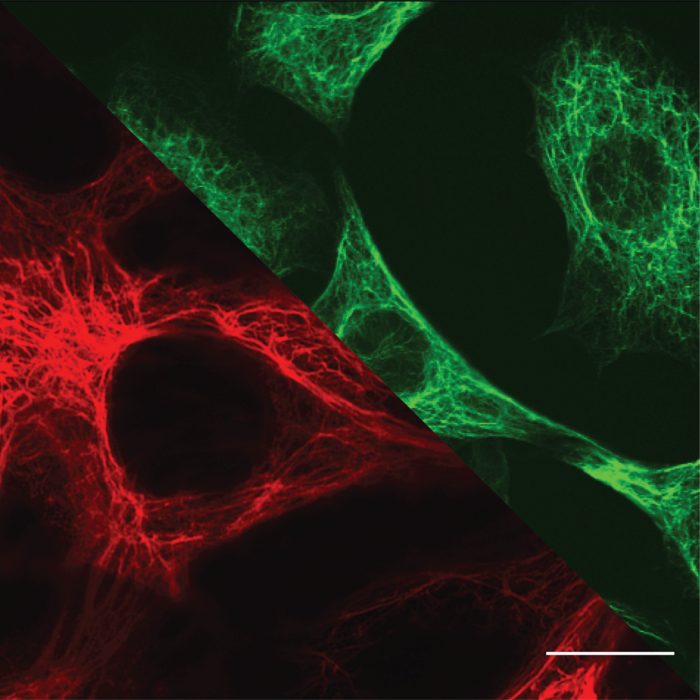 Microscopy images of biological cells: top right (green) - Vimentin intermediate filaments in fibroblasts; bottom left (red) - Keratin intermediate filaments in epithelial cells. Scale: 10 µm.