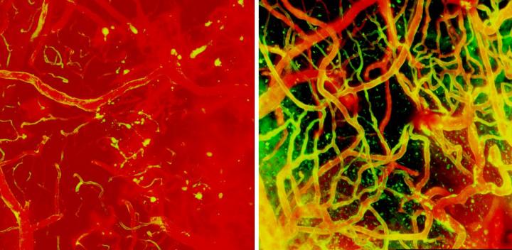 Injury and repair of mouse brain blood vessels