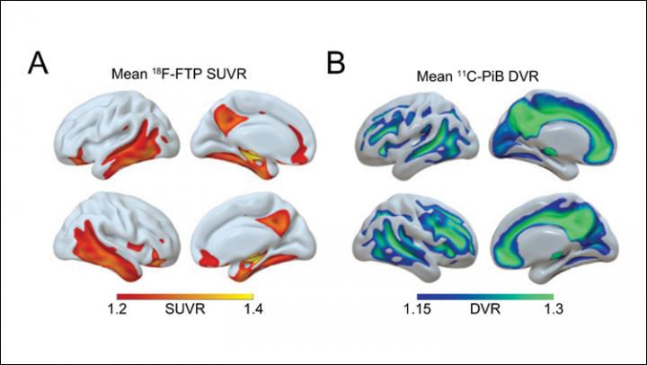 Tau and &#946;-amyloid Distribution