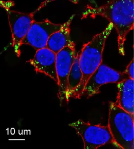 Metal–biomolecule network nanoparticles (MBN NPs) in cells.