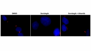 Mechanism involved in rare pediatric brain