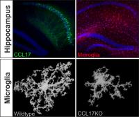 CCL17-Producing Neurons and Microglia