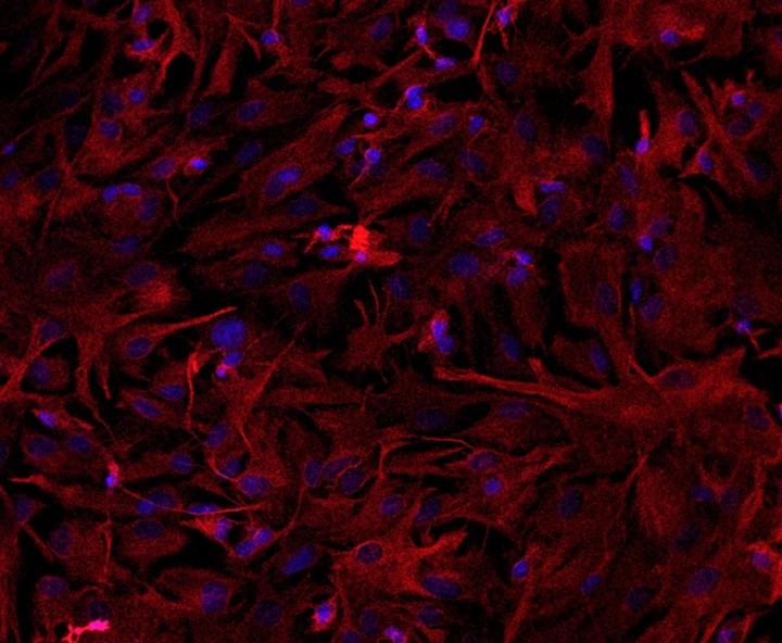 Astrocytes in Culture