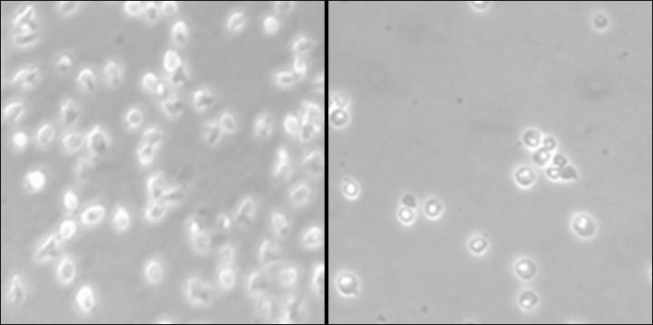 Treated MCL Cells