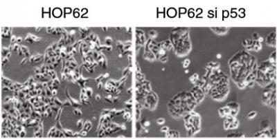 Switching Side in Cancer (1 of 2)