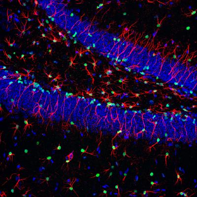 Neural Stem Cells
