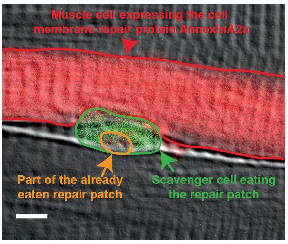 Scavenger Cells Repair Muscle Fibers