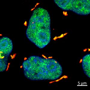 Unravelling the Mystery of DHX9 Granules