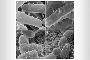 Visualisation of the adsorption of phages on E. coli bacteria.