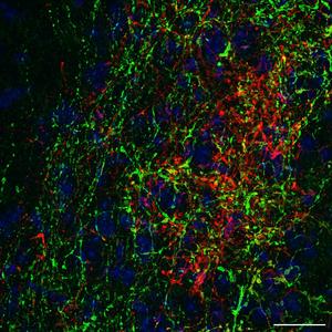 Microscopic view of cells in the inferior colliculus region of the brain