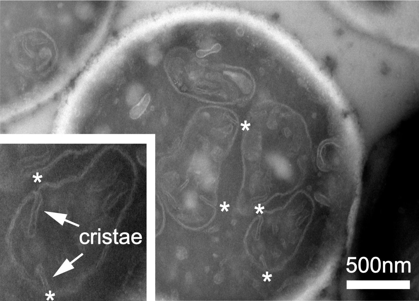 Electron Micrograph of a Section Through a Eukaryotic Yeast Cell