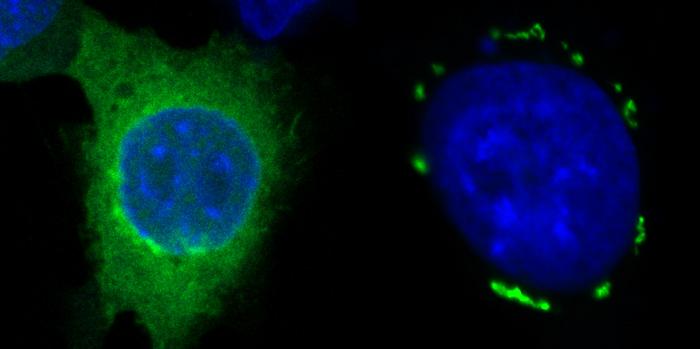 FSP1 condensates in green induced by icFSP1 surrounding a blue nucleus.