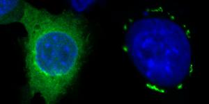 FSP1 condensates in green induced by icFSP1 surrounding a blue nucleus.