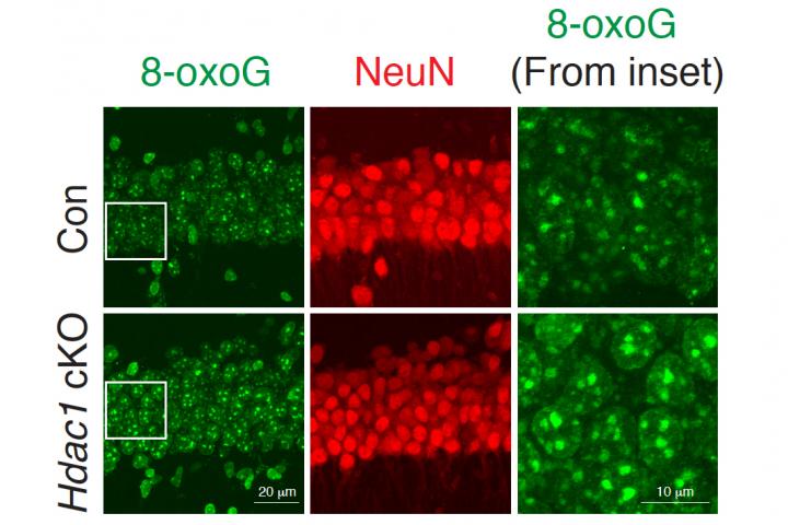 Aging Neurons