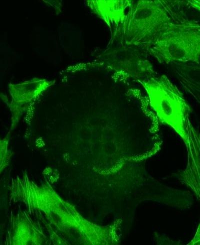 Confocal Microscope Image of Osteoclast