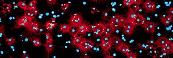Mutant PMD Oligodendrocytes