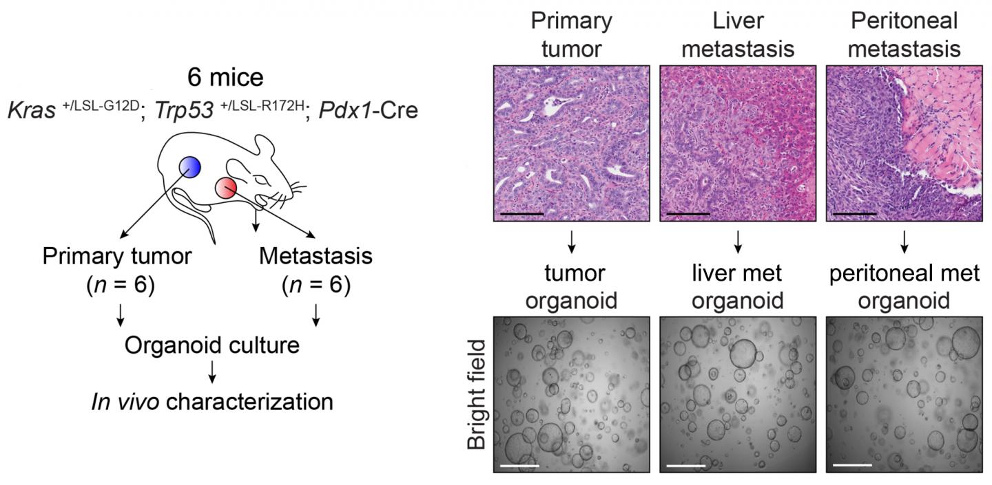 Tracing Metastasis in Pancreatic Cancer