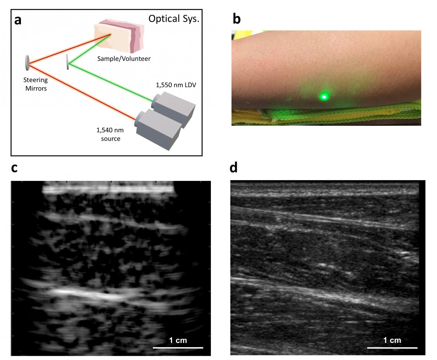 Laser Ultrasound System Schematic and Human Subject Images