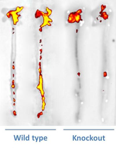Safer Alternatives to Nonsteroidal Antinflamatory Pain Killers