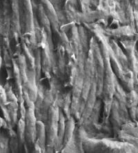Melanosomes under the Microscope