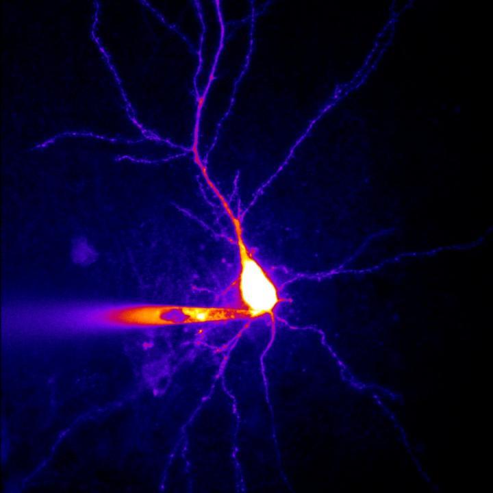 Neuron from the Hippocampus of a Rat