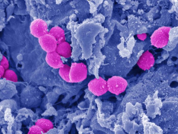 Streptococcus pyogenes