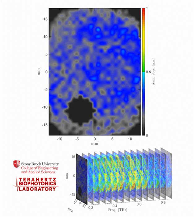 THz spectroscopic image of burn