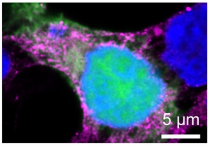 Lassa virus image