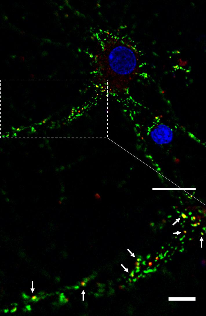 Alpha-Synuclein and PrPC Interacting in a Neuron