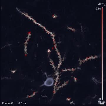 In-Vivo Glutamate Imaging