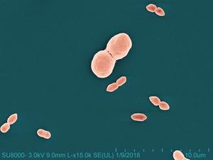 Roseomonas mucosa bacteria