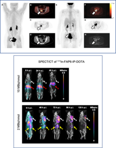 FAPI PET Imaging Superior for Diagnosing Multiple Types of Cancer, with Potential for Targeted Treatment