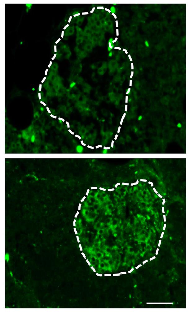 Modification of Proteins in Pancreatic Beta Cells
