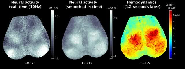 Neural Activity/Hemodynamics