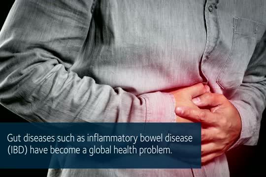 New, Noninvasive Test for Bowel Diseases