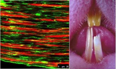 Homeostasis of Mouse Incisor Disrupted by Denervation
