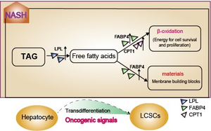 New Study Sheds Light on How Fatty Liver Disease Turns Into Liver Cancer