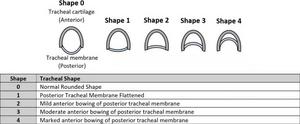 THORACIC CT IMAGING IN OBESITY: TECHNICAL CHALLENGES, IMAGING DINDINGS AND FUTURE OUTLOOK.