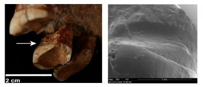 Neanderthals Used Toothpicks to Alleviate the Pain of Diseases Such As Inflammation of the Gums