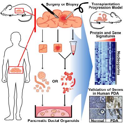 Scientists Develop the First 3-D Culture System for Pancreatic Cancer
