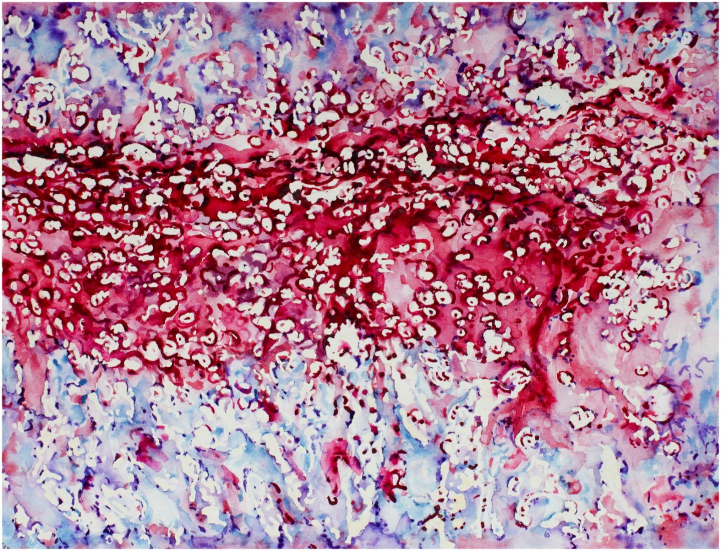 Watercolor of Endochondral Ossification